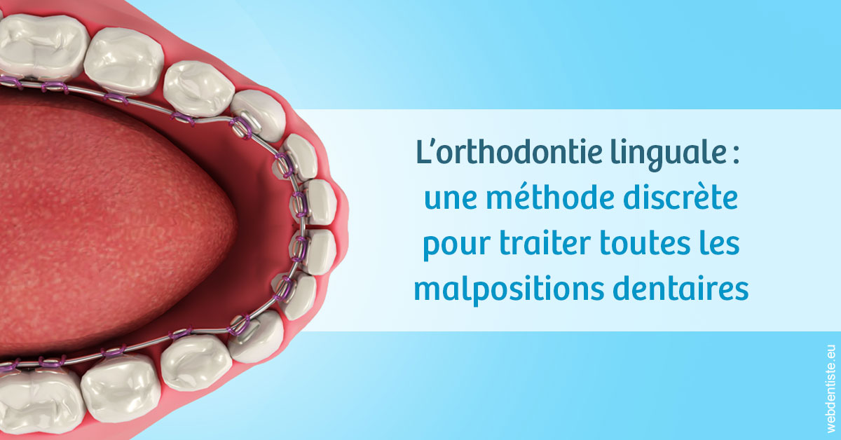 https://dr-stephanie-cohere-martin.chirurgiens-dentistes.fr/L'orthodontie linguale 1