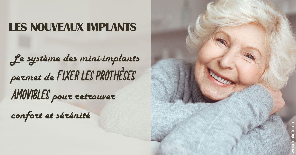 https://dr-stephanie-cohere-martin.chirurgiens-dentistes.fr/Les nouveaux implants 1