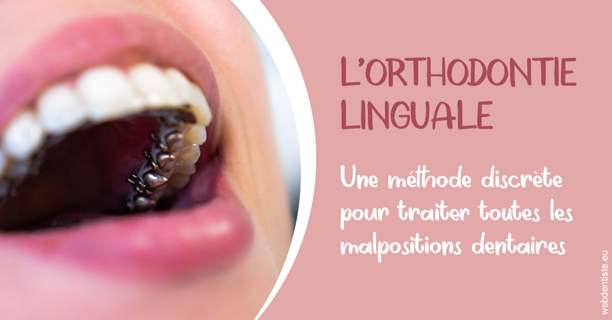 https://dr-stephanie-cohere-martin.chirurgiens-dentistes.fr/L'orthodontie linguale 2