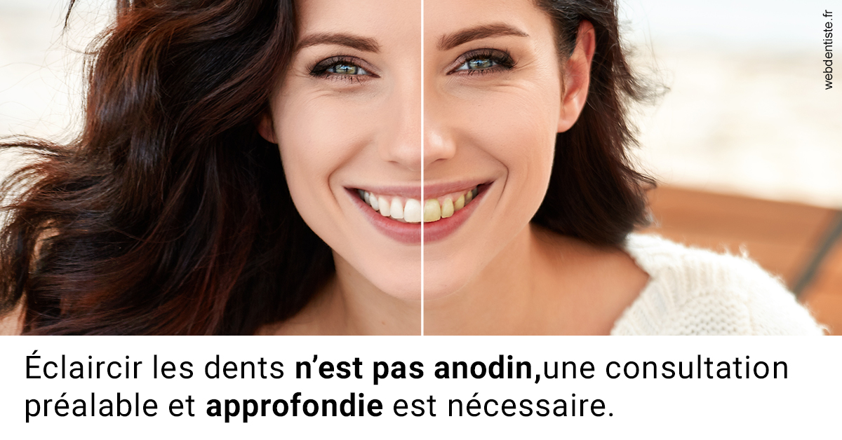 https://dr-stephanie-cohere-martin.chirurgiens-dentistes.fr/Le blanchiment 2