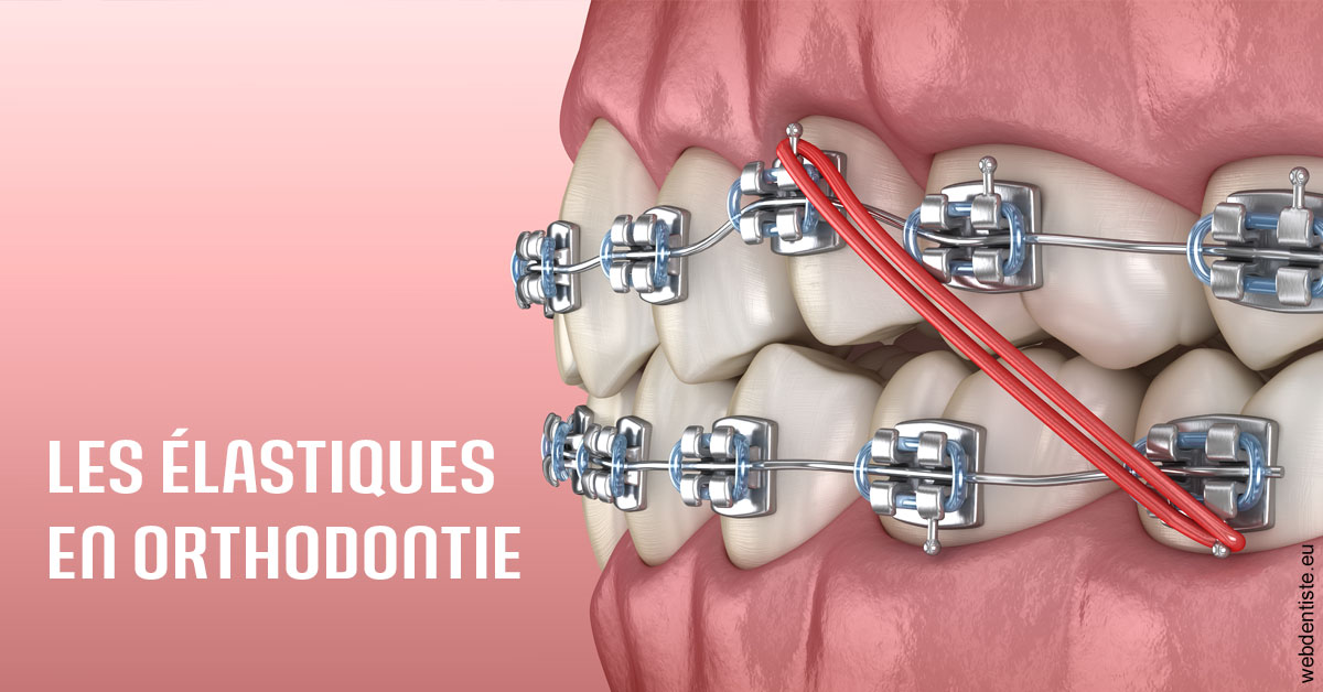 https://dr-stephanie-cohere-martin.chirurgiens-dentistes.fr/Elastiques orthodontie 2