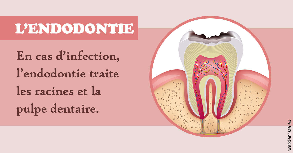 https://dr-stephanie-cohere-martin.chirurgiens-dentistes.fr/L'endodontie 2